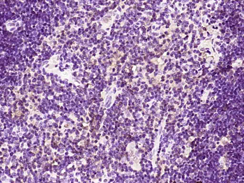 Gemin 2 Rabbit Polyclonal Antibody