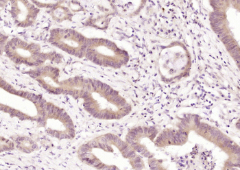 Gemin 4 Rabbit Polyclonal Antibody