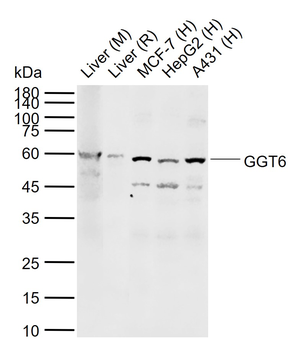 GGT6 Rabbit Polyclonal Antibody
