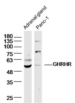 GHRHR Rabbit Polyclonal Antibody