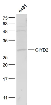GIYD2 Rabbit Polyclonal Antibody