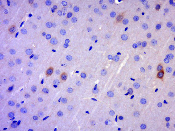 GK2 Rabbit Polyclonal Antibody