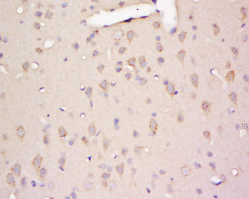 GK3P Rabbit Polyclonal Antibody