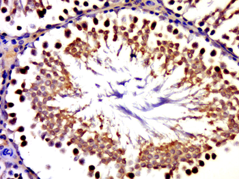 GLE1 Rabbit Polyclonal Antibody