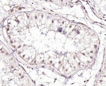 Gli2 Rabbit Polyclonal Antibody