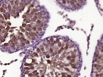 Gli3 Rabbit Polyclonal Antibody