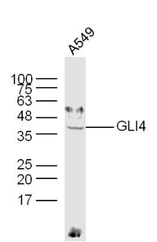 GLI4 Rabbit Polyclonal Antibody