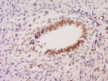 GLI4 Rabbit Polyclonal Antibody