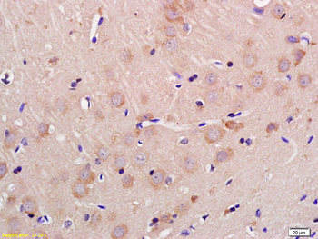 GLS2 Rabbit Polyclonal Antibody
