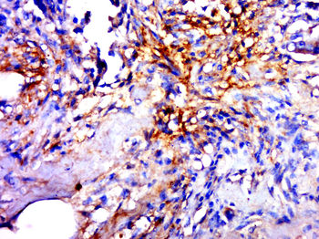 GLT1D1 Rabbit Polyclonal Antibody