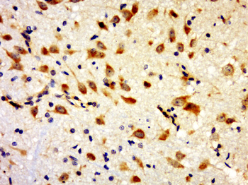 GLT1D1 Rabbit Polyclonal Antibody