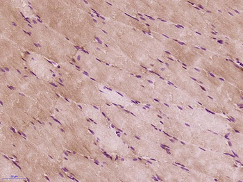 GLT25D2 Rabbit Polyclonal Antibody