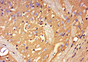 GLT25D2 Rabbit Polyclonal Antibody