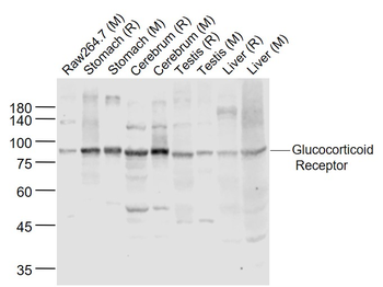 Glucocorticoid Receptor Rabbit Polyclonal Antibody