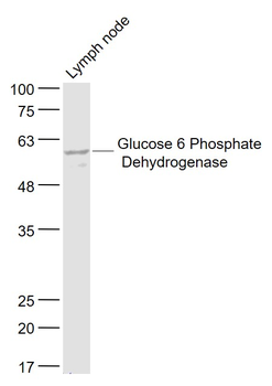 Glucose 6 Phosphate Dehydrogenase Rabbit Polyclonal Antibody