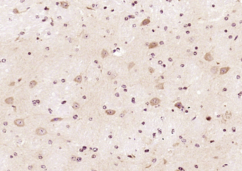 QARS/Glutamyl Prolyl tRNA synthetase/ProRS Rabbit Polyclonal Antibody