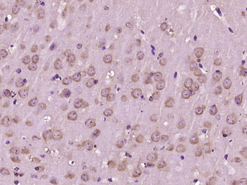 Glutathione Transferase zeta 1 Rabbit Polyclonal Antibody