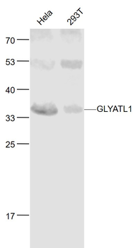 GLYATL1 Rabbit Polyclonal Antibody