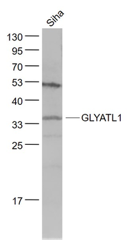 GLYATL1 Rabbit Polyclonal Antibody