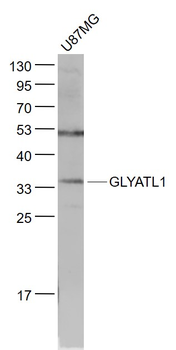 GLYATL1 Rabbit Polyclonal Antibody