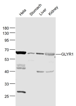 GLYR1 Rabbit Polyclonal Antibody