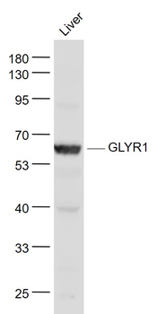 GLYR1 Rabbit Polyclonal Antibody