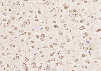 GMF beta Rabbit Polyclonal Antibody
