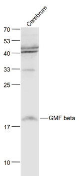 GMF beta Rabbit Polyclonal Antibody