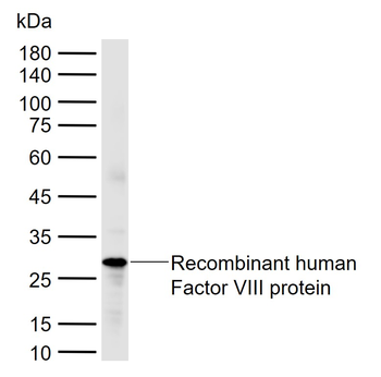 Factor VIII Rabbit Polyclonal Antibody