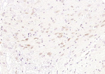 GNPDA2 Rabbit Polyclonal Antibody