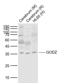 ZDHHC3 Rabbit Polyclonal Antibody