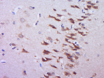 GOLT1A Rabbit Polyclonal Antibody