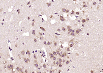 GOT1L1 Rabbit Polyclonal Antibody