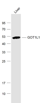 GOT1L1 Rabbit Polyclonal Antibody