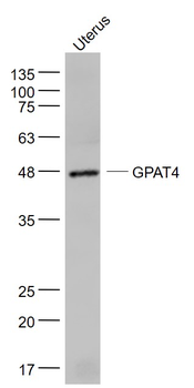 GPAT4 Rabbit Polyclonal Antibody
