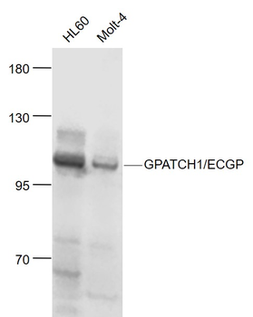 GPATCH1/ECGP Rabbit Polyclonal Antibody