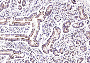 GPBAR1 Rabbit Polyclonal Antibody