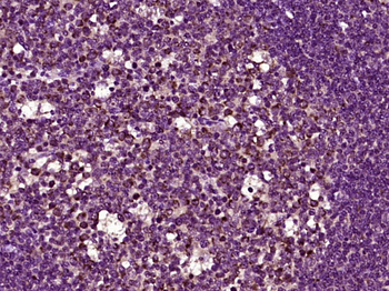 GPBAR1 Rabbit Polyclonal Antibody