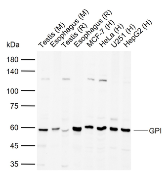 GPI Rabbit Polyclonal Antibody