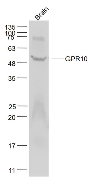 GPR10 Rabbit Polyclonal Antibody