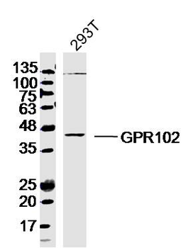 GPR102 Rabbit Polyclonal Antibody