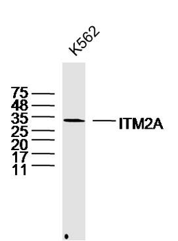 ITM2A Rabbit Polyclonal Antibody