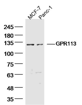 GPR113 Rabbit Polyclonal Antibody