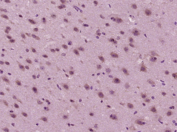 GPR125 Rabbit Polyclonal Antibody