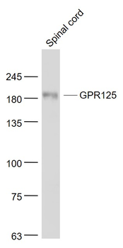 GPR125 Rabbit Polyclonal Antibody