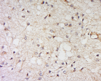 GPR125 Rabbit Polyclonal Antibody