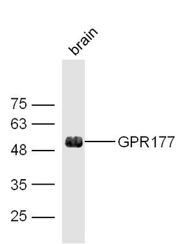 GPR177 Rabbit Polyclonal Antibody