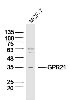GPR21 Rabbit Polyclonal Antibody
