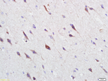 GPR25 Rabbit Polyclonal Antibody