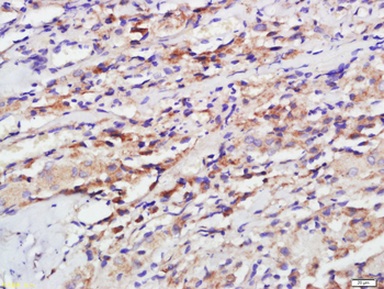 GPR25 Rabbit Polyclonal Antibody